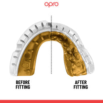 מגן שיניים לגשר OPRO Gold מקצועי