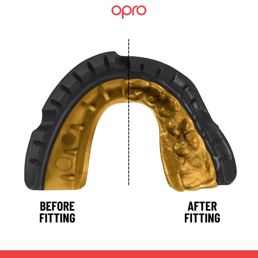 מגן שיניים לגשר OPRO Gold מקצועי